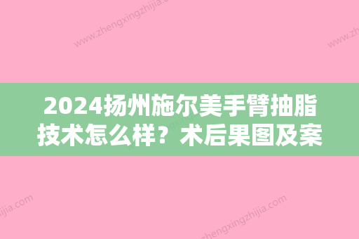 2024扬州施尔美手臂抽脂技术怎么样？术后果图及案例一览