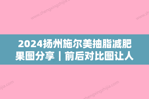 2024扬州施尔美抽脂减肥果图分享｜前后对比图让人惊讶！