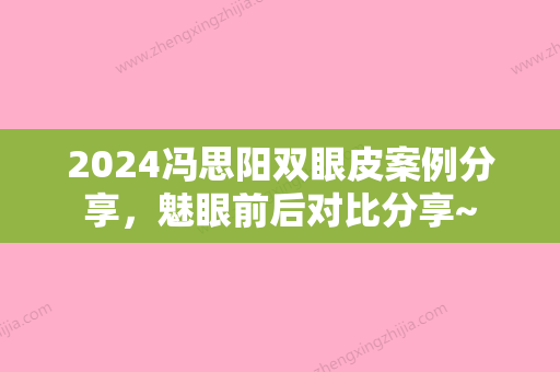 2024冯思阳双眼皮案例分享，魅眼前后对比分享~