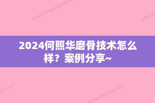 2024何照华磨骨技术怎么样？案例分享~