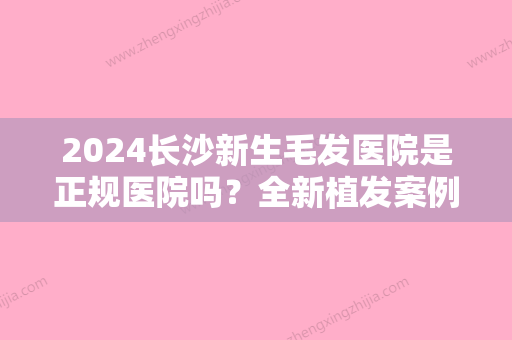 2024长沙新生毛发医院是正规医院吗？全新植发案例分享