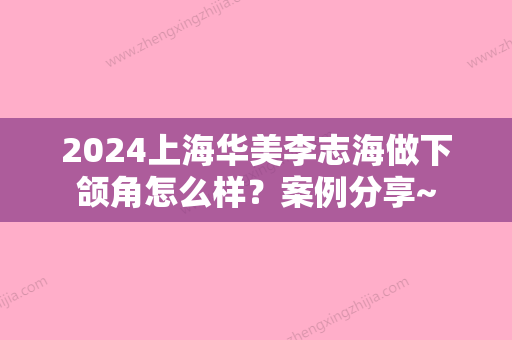 2024上海华美李志海做下颌角怎么样？案例分享~