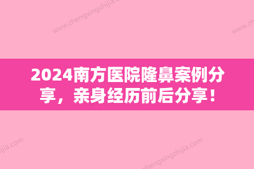 2024南方医院隆鼻案例分享	，亲身经历前后分享！