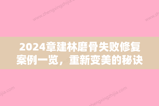 2024章建林磨骨失败修复案例一览	，重新变美的秘诀~