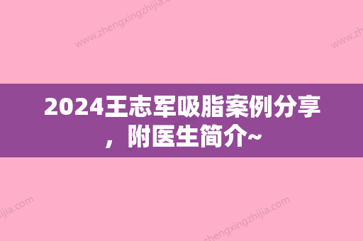 2024王志军吸脂案例分享，附医生简介~