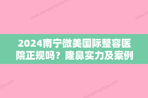 2024南宁微美国际整容医院正规吗？隆鼻实力及案例曝光