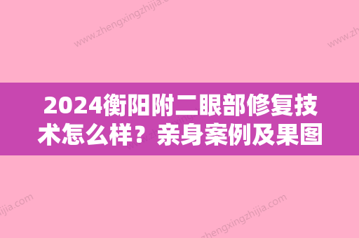 2024衡阳附二眼部修复技术怎么样？亲身案例及果图一览