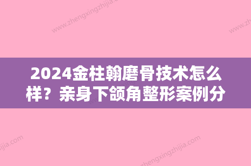 2024金柱翰磨骨技术怎么样？亲身下颌角整形案例分享~