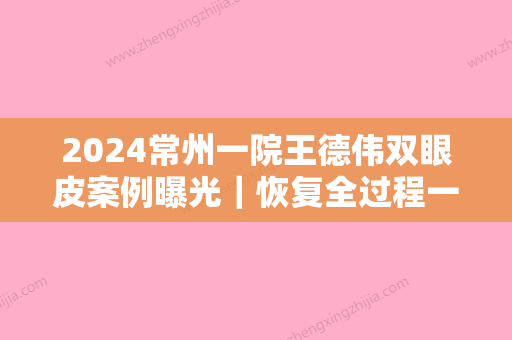 2024常州一院王德伟双眼皮案例曝光｜恢复全过程一览