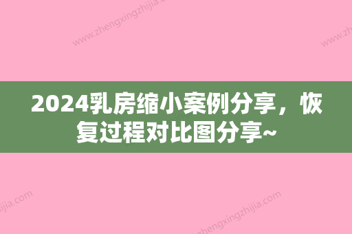 2024乳房缩小案例分享，恢复过程对比图分享~