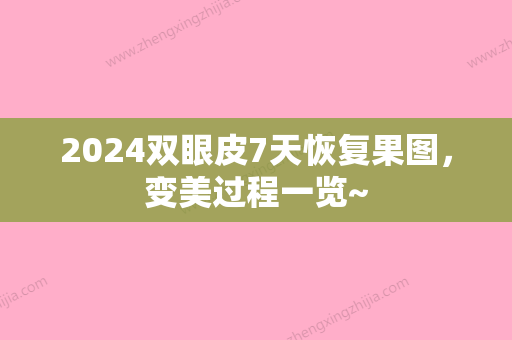 2024双眼皮7天恢复果图，变美过程一览~