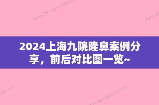 2024上海九院隆鼻案例分享，前后对比图一览~