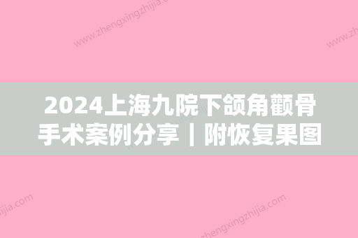 2024上海九院下颌角颧骨手术案例分享｜附恢复果图