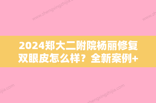 2024郑大二附院杨丽修复双眼皮怎么样？全新案例+果图一览