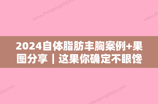 2024自体脂肪丰胸案例+果图分享｜这果你确定不眼馋？