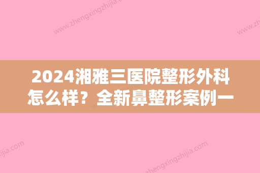 2024湘雅三医院整形外科怎么样？全新鼻整形案例一览~