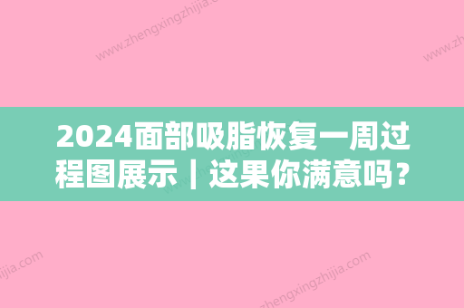 2024面部吸脂恢复一周过程图展示｜这果你满意吗？