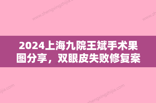 2024上海九院王斌手术果图分享，双眼皮失败修复案例一览！