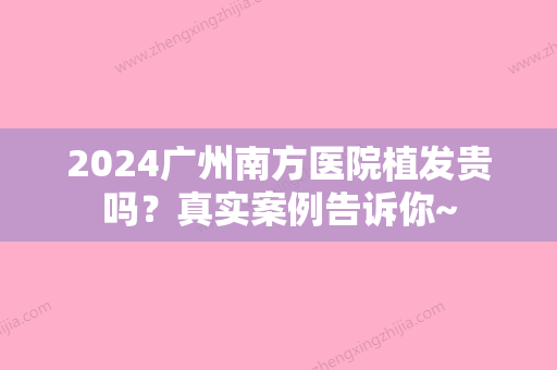 2024广州南方医院植发贵吗？真实案例告诉你~