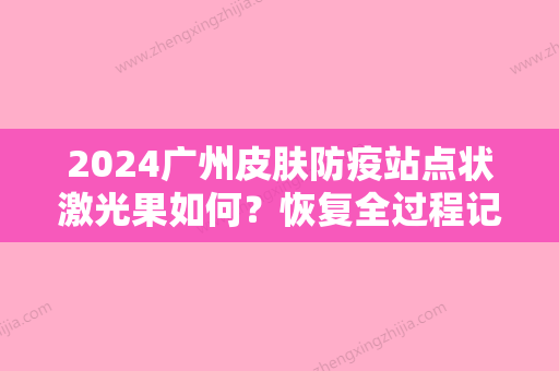 2024广州皮肤防疫站点状激光果如何？恢复全过程记录~