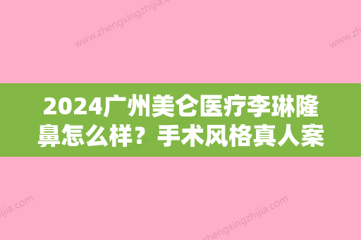 2024广州美仑医疗李琳隆鼻怎么样？手术风格真人案例分享！