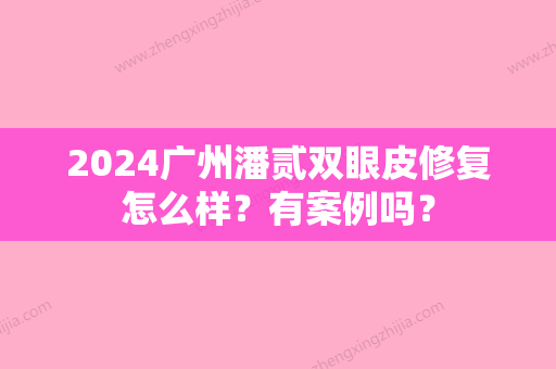 2024广州潘贰双眼皮修复怎么样？有案例吗？