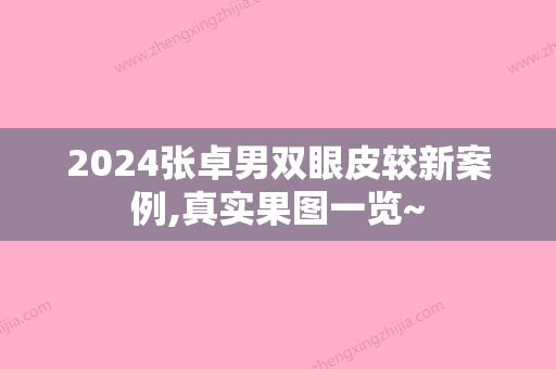 2024张卓男双眼皮较新案例,真实果图一览~