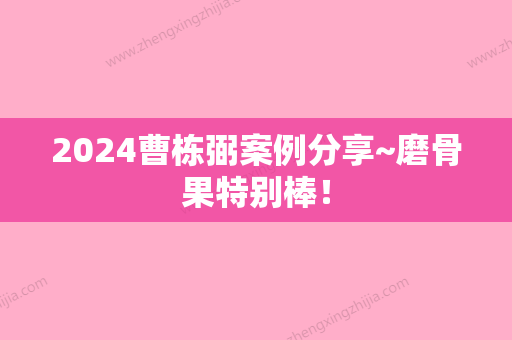 2024曹栋弼案例分享~磨骨果特别棒！