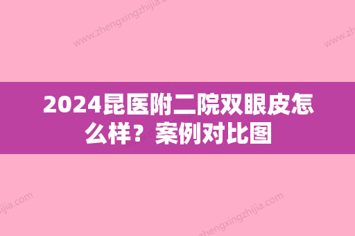 2024昆医附二院双眼皮怎么样？案例对比图