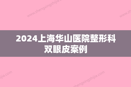 2024上海华山医院整形科双眼皮案例