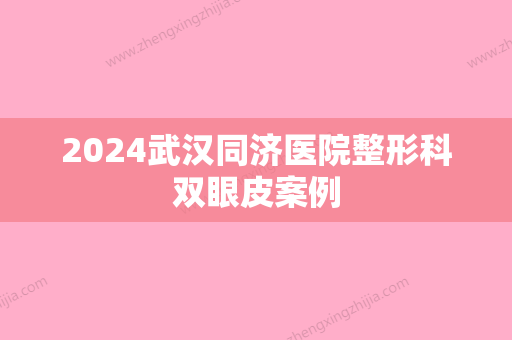 2024武汉同济医院整形科双眼皮案例