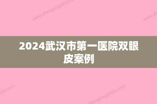 2024武汉市第一医院双眼皮案例