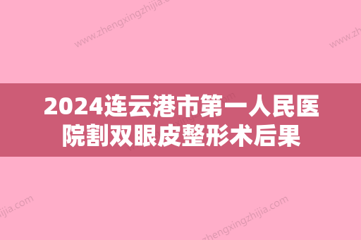 2024连云港市第一人民医院割双眼皮整形术后果