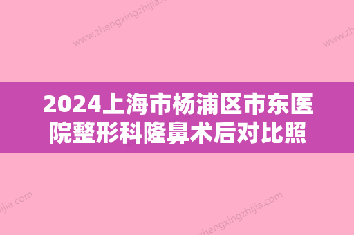 2024上海市杨浦区市东医院整形科隆鼻术后对比照