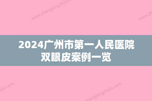 2024广州市第一人民医院双眼皮案例一览