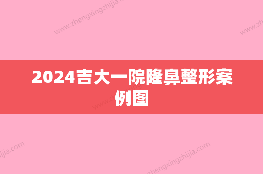 2024吉大一院隆鼻整形案例图