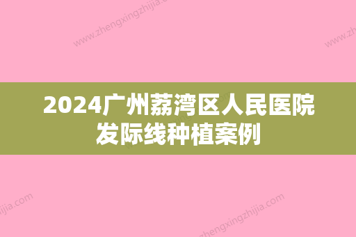 2024广州荔湾区人民医院发际线种植案例