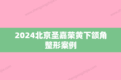 2024北京圣嘉荣黄下颌角整形案例