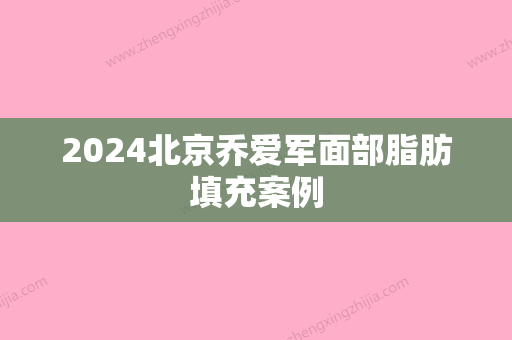 2024北京乔爱军面部脂肪填充案例