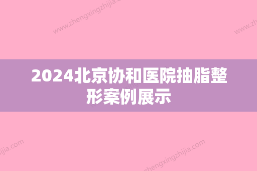 2024北京协和医院抽脂整形案例展示