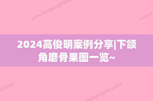 2024高俊明案例分享|下颌角磨骨果图一览~