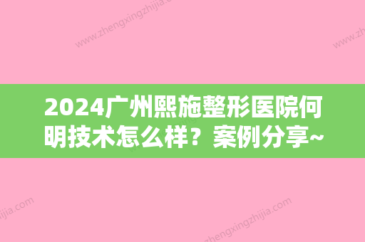 2024广州熙施整形医院何明技术怎么样？案例分享~