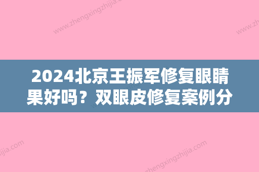 2024北京王振军修复眼睛果好吗？双眼皮修复案例分享