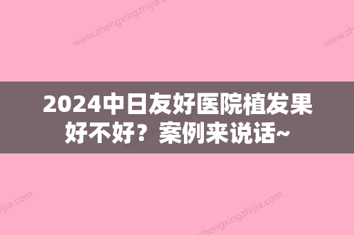 2024中日友好医院植发果好不好？案例来说话~