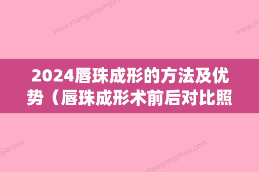 2024唇珠成形的方法及优势（唇珠成形术前后对比照(图)）(唇珠什么时候定型)