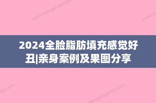 2024全脸脂肪填充感觉好丑|亲身案例及果图分享