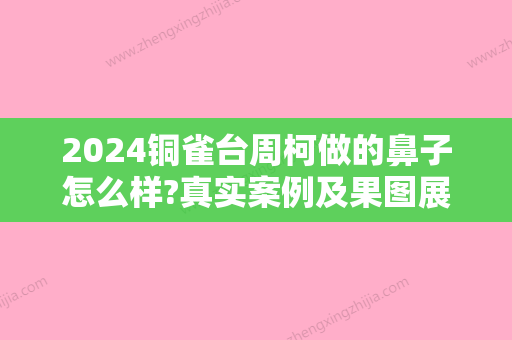 2024铜雀台周柯做的鼻子怎么样?真实案例及果图展示