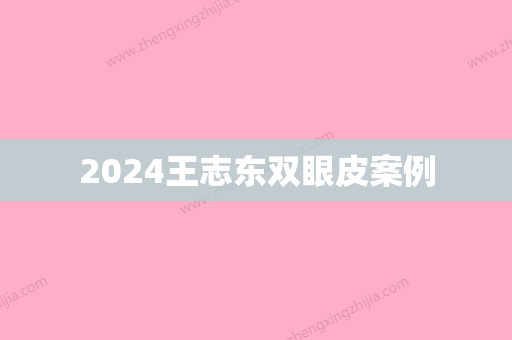 2024王志东双眼皮案例