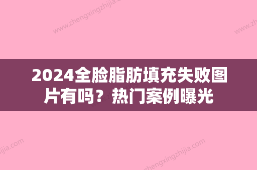 2024全脸脂肪填充失败图片有吗？热门案例曝光