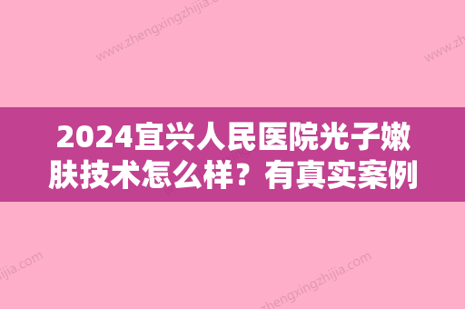 2024宜兴人民医院光子嫩肤技术怎么样？有真实案例吗？